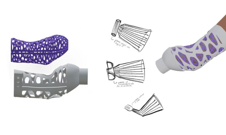 Encaja 3D-Printable Prosthetic Socket Wins Dyson Award